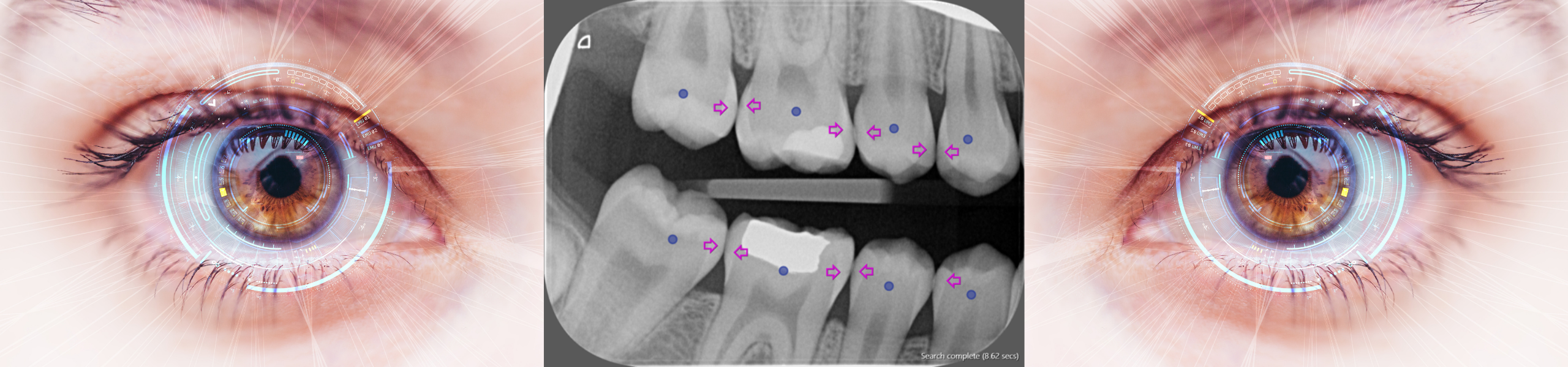 X-Ray Dental Challenge